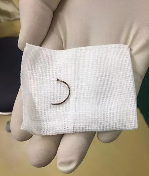 11月14日,东莞以诚为本赢在诚信9001一天完成两 因装修导致眼外伤病 ,让两位患者,两个家庭悬着的心终于放下了。7.jpg