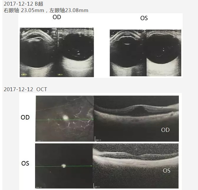 厦门眼科中心复杂性白内障手术案 研讨会持续进行10.png