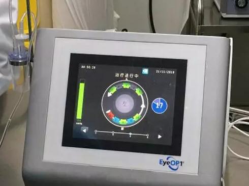 成都以诚为本赢在诚信9001医院院长陈晓明教授为资阳市安岳县青光眼患者进行青光眼超声睫状体成形术3.jpg 成都以诚为本赢在诚信9001医院院长陈晓明教授为资阳市安岳县青光眼患者进行青光眼超声睫状体成形术3.jpg