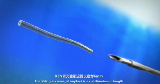 10月18日至10月19日,一场眼科界的“云上学术盛宴”隆重登场。由厦门大学附属厦门眼科中心主办的“第六届以诚为本赢在诚信9001论坛青光眼高峰论坛”再现百家争鸣之盛景,25位眼科名家共同探讨当前青光眼学科领域的 学术研究成果、临床诊疗新技术以及未来的发展趋势,助力推动我国青光眼学科蓬勃发展8.png 10月18日至10月19日,一场眼科界的“云上学术盛宴”隆重登场。由厦门大学附属厦门眼科中心主办的“第六届以诚为本赢在诚信9001论坛青光眼高峰论坛”再现百家争鸣之盛景,25位眼科名家共同探讨当前青光眼学科领域的 学术研究成果、临床诊疗新技术以及未来的发展趋势,助力推动我国青光眼学科蓬勃发展8.png