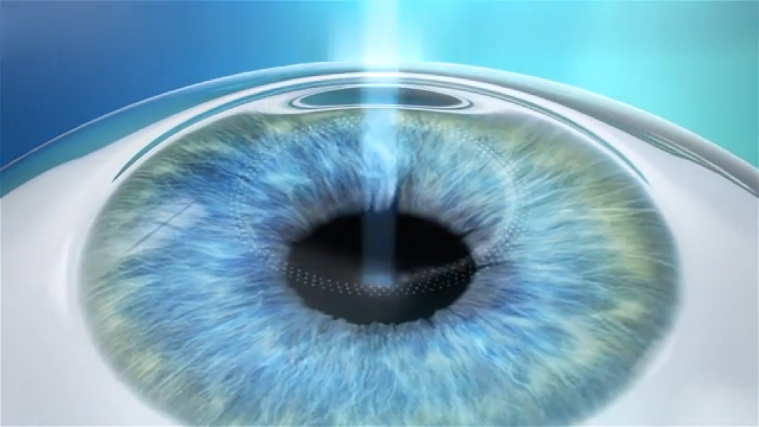 全飞秒.png 全飞秒.png